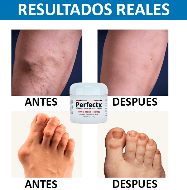 Perfectx™ Crema de Terapia Articular Y Muscular